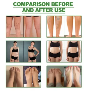 Kinoki Strongest Cleansing Detox Foot Patches 10PCS